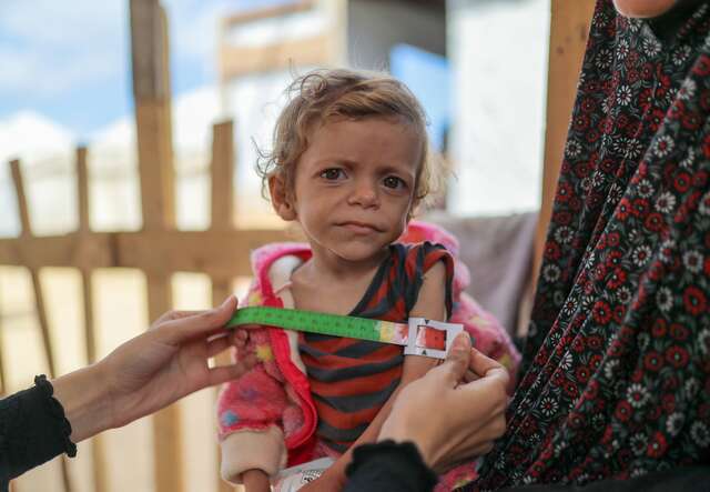 A young girl in Gaza is screened for signs of malnutrition.