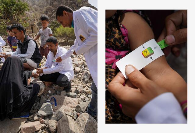 In one photo two men in medical coats examine a woman seated on rocks.The second photo shows a tape used to measure a child's upper arm in malnutrition screenings.
