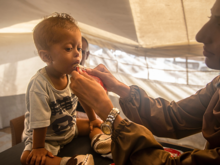 En liten pojke får behandling mot undernäring av RESCUE i Gaza City.