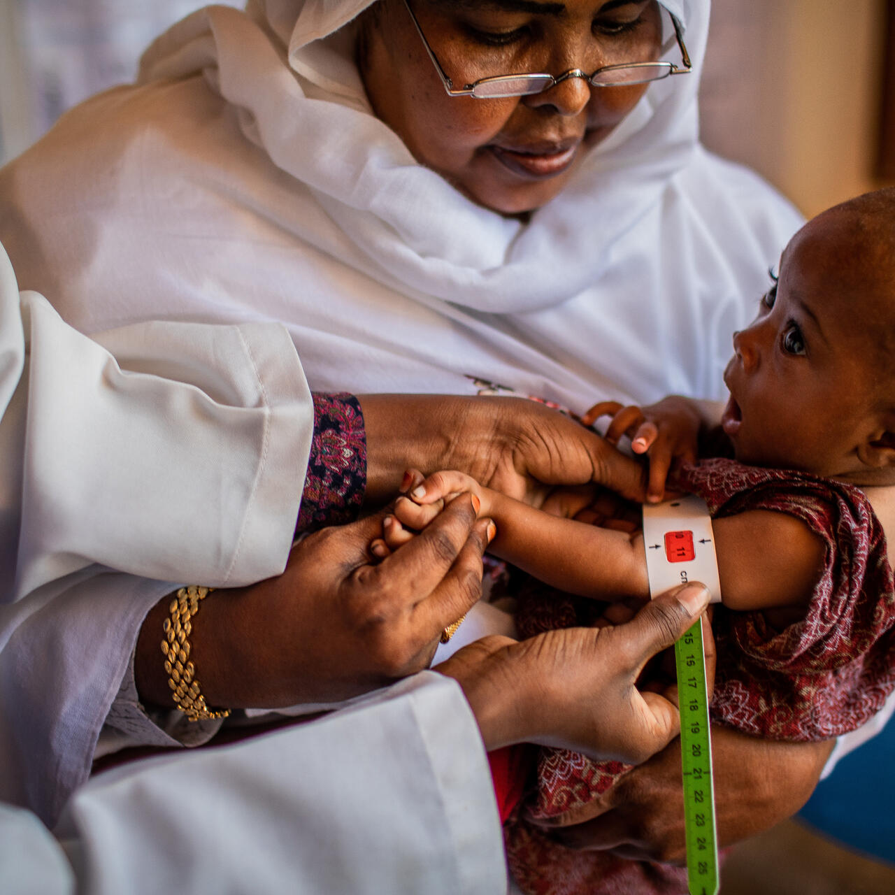 A health worker in Somalia measures a baby's upper arm with a special measuring tape to check for signs of malnutrition.