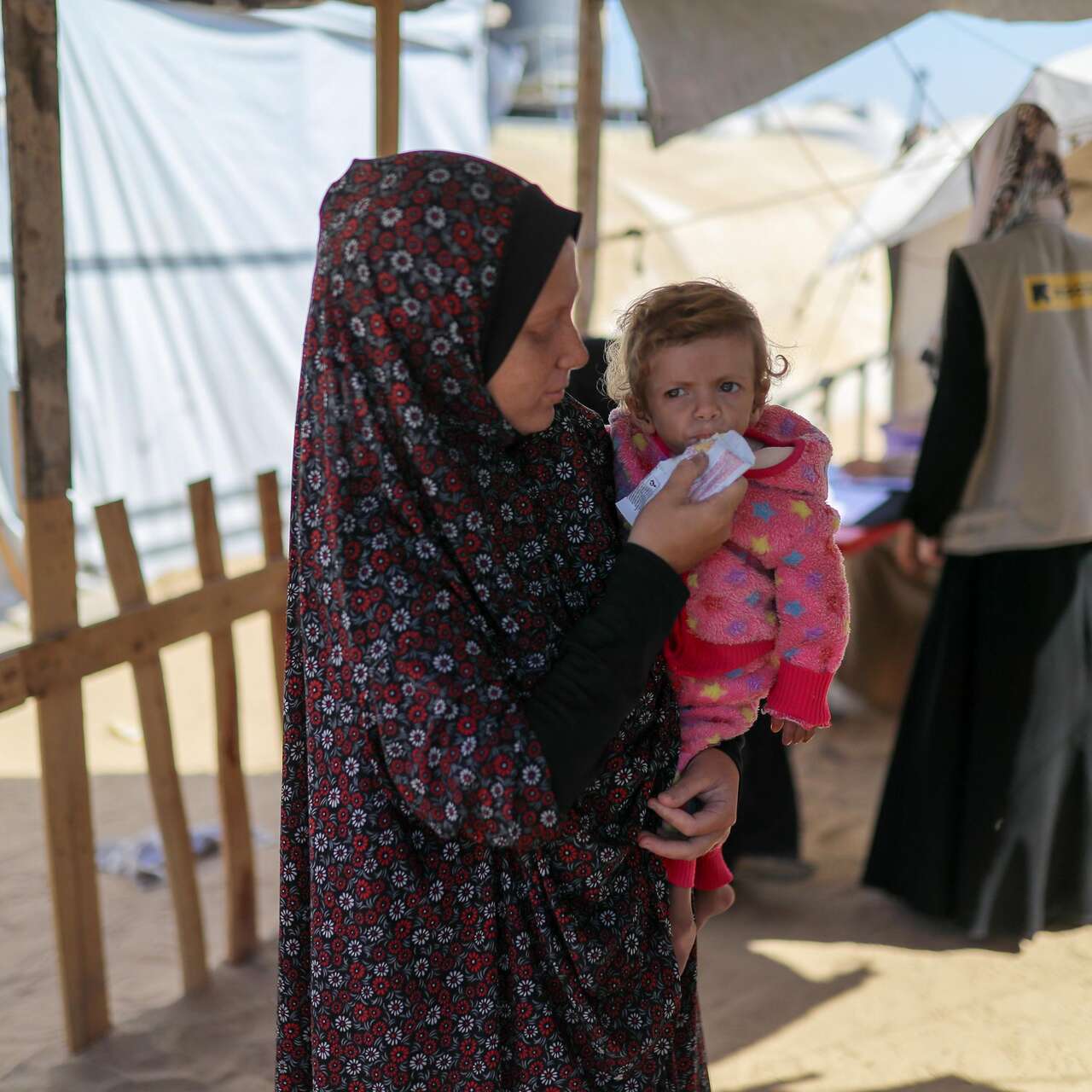 A child receives treatment for malnutrition in Shams Camp, Gaza