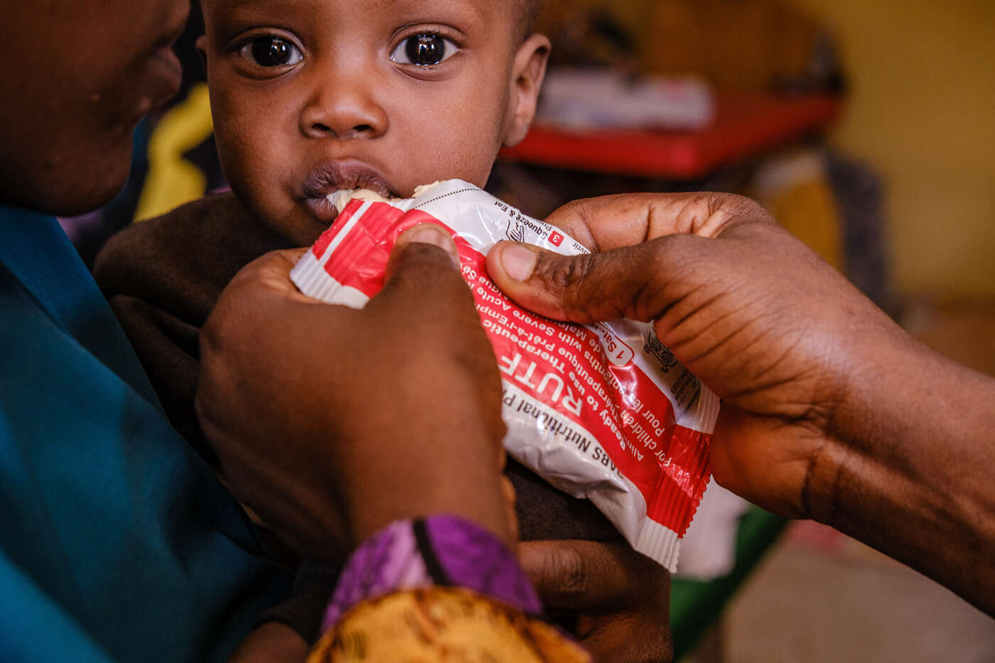 Ett litet barn matas med nötkräm - ett effektivt sätt att ge undernärda barn näring.