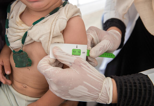 A baby being treated by a health worker