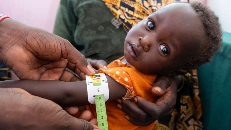 A child is screened for signs of malnutrition.